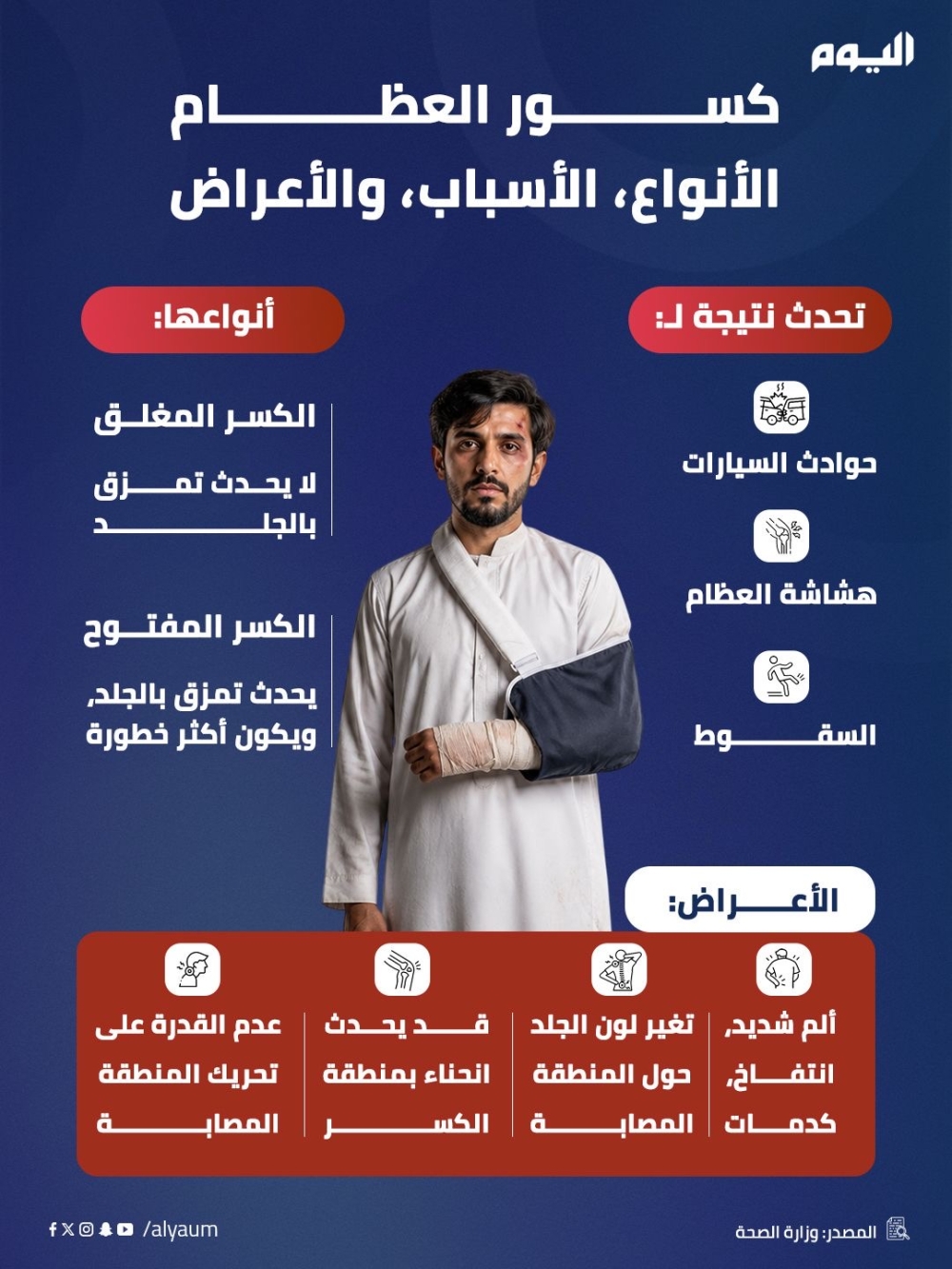 كسور العظام.. الأنواع والأسباب والأعراض 