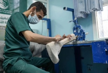مركز الأطراف الصناعية في مأرب يقدم خدماته لـ 497 مستفيدًا خلال مايو