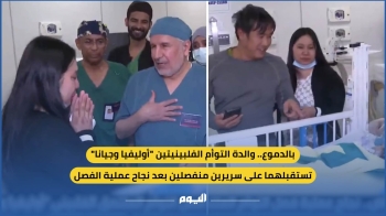  إنجاز طبي سعودي جديد.. فصل التوأم الفلبيني بعد عملية استغرقت 6 ساعات - اليوم