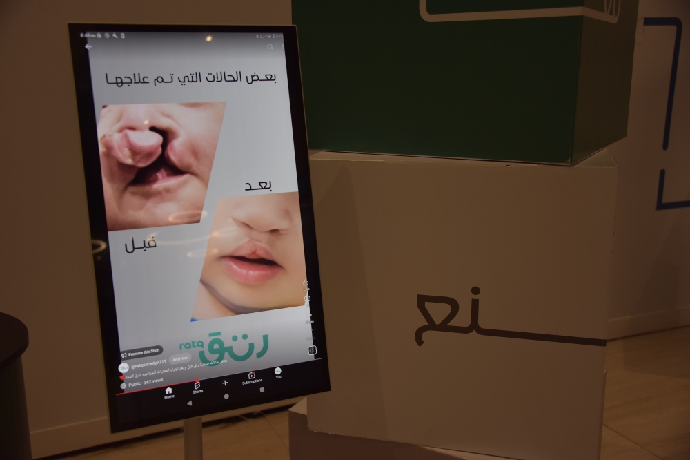 فيديو| مختصون: زواج الأقارب يرفع معدلات الشفة الأرنبية في المملكة.. وحملة لدعم المصابين بالشرقية