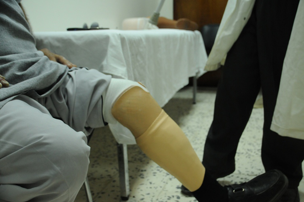 السكري يتسبب ببتر أطراف العديد من المرضى 